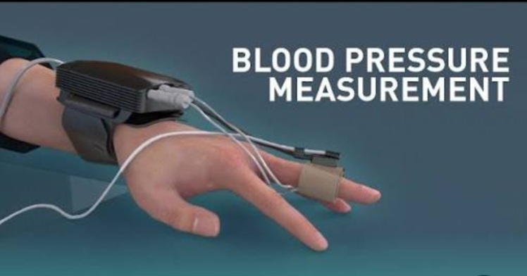 مقاله تجهیزات پزشکی، دستگاه فیناپرس