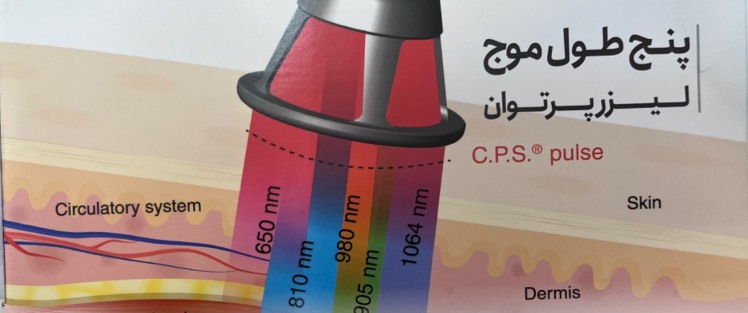 معرفی طول موج ها لیزر پر توان
