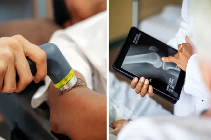 ترمیم استخوان با یک اسلحه!