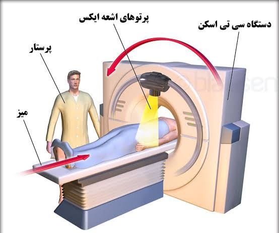 نکته آموزشی : سیستم تصویربرداری از بدن در CT