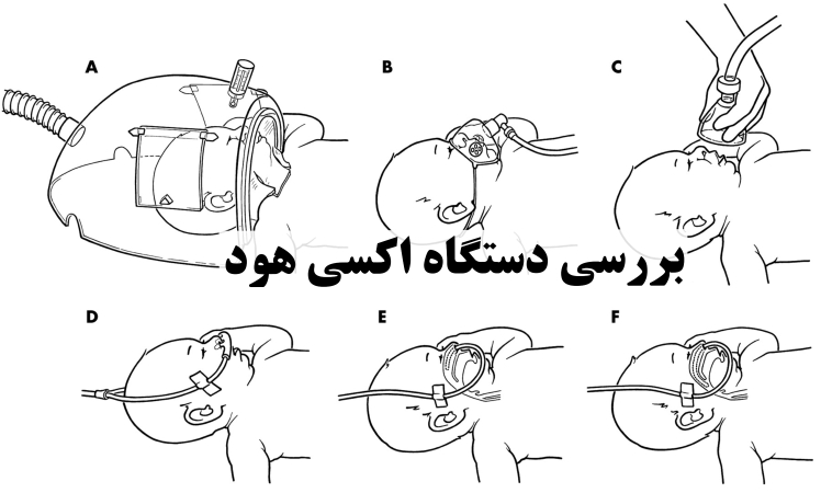  بررسی دستگاه اکسی‌هود نوزاد، مشکلات و نگهداری آن